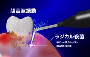 99.99%の高い殺菌効果