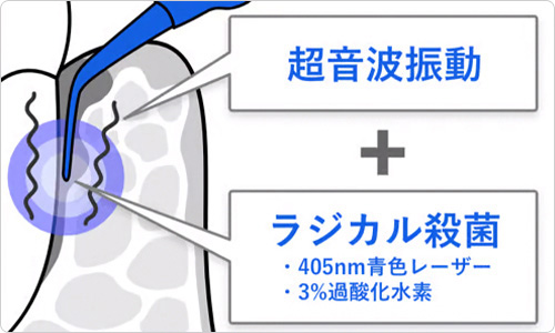 ブルーラジカル P-01