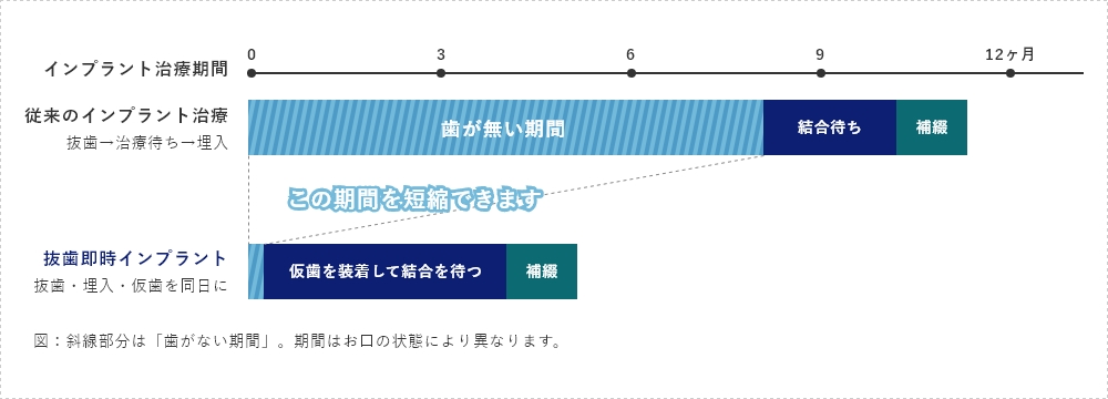 「歯がない期間」が、ここまで変わります