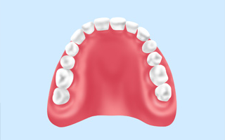 厚みのあるレジン床義歯